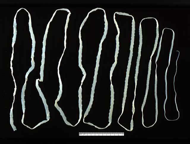 tapeworm